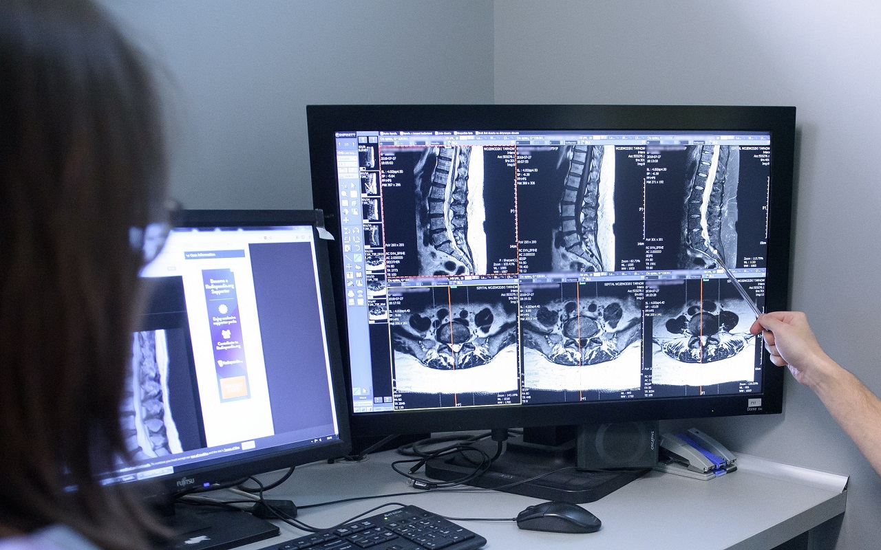 Dwa monitory komputerowe przedstawiające wyniki badania obrazowego kręgosłupa, prawdopodobnie analizowane i omawiane przez personel medyczny, na co wskazywać może ręka z długopisem wskazująca punkt na ekranie monitora