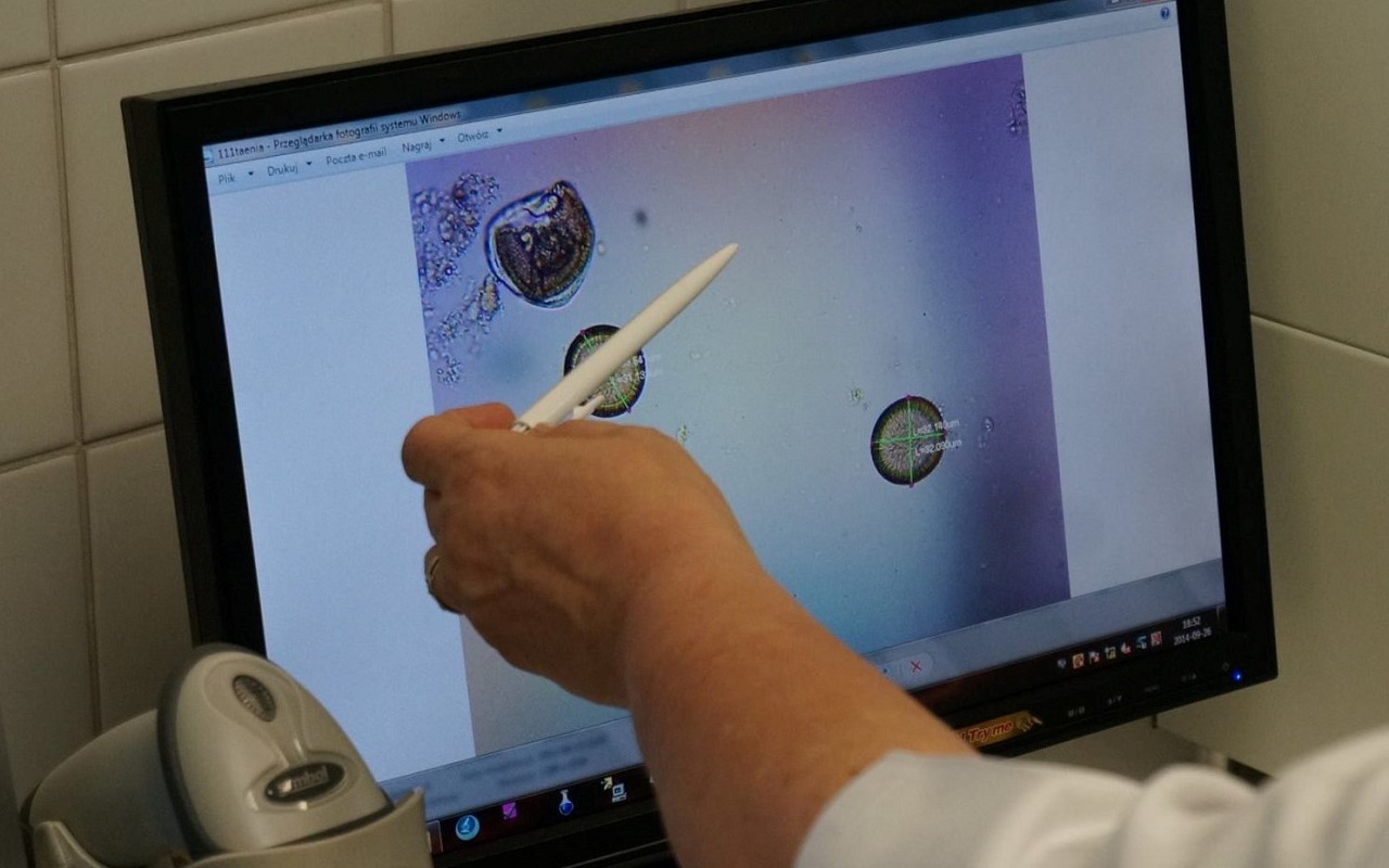 Na ekranie monitora wyświetlany jest obraz z badania cytologicznego, pracownik Szpitala za pomocą wskaźnika pokazuje punkt na ekranie