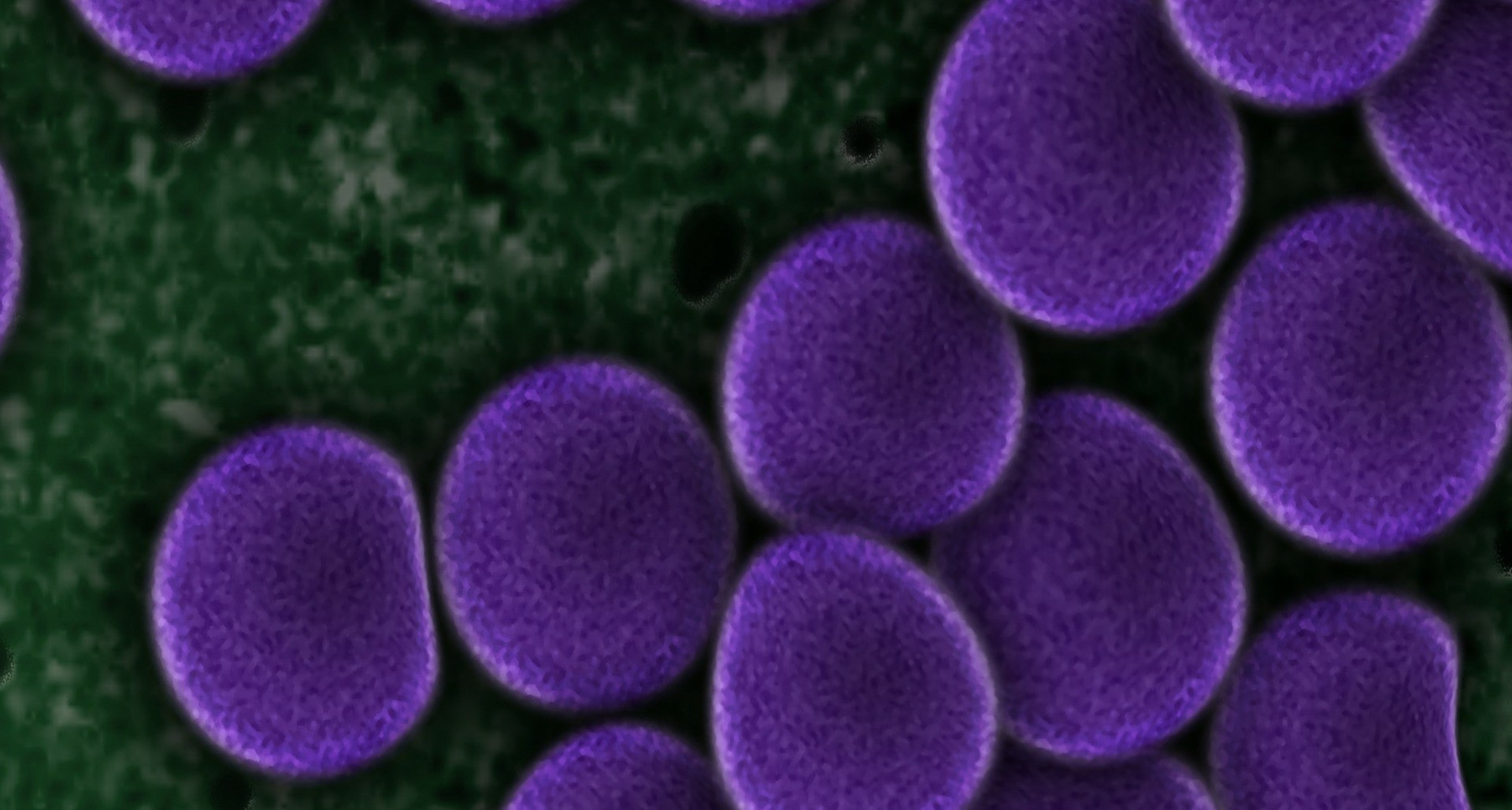 Widok bakterii meningokoków pod mikroskopem. Liczne fioletowe kuliste kształty.