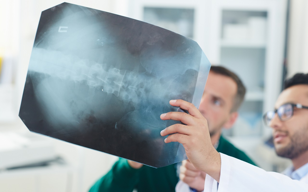 Lekarz omawiający z pacjentem wynik badania rentgenowskiego kręgosłupa