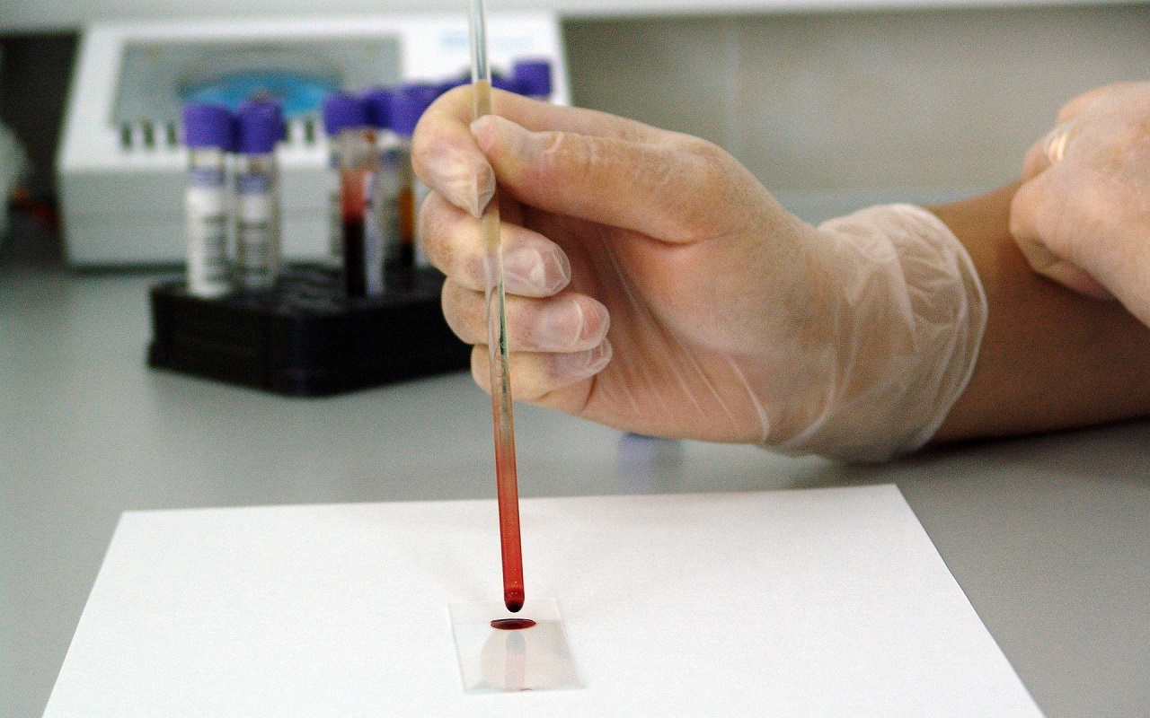 laborant przygotowuje próbkę krwi do badania